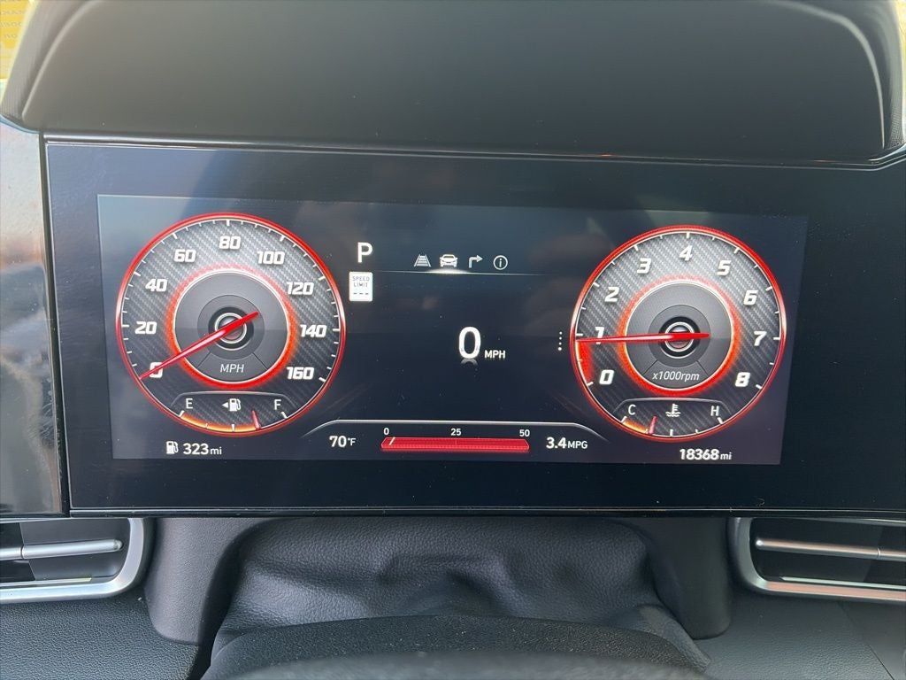 2024 Hyundai ELANTRA SEL CLEAN 1 OWNER CARFAX